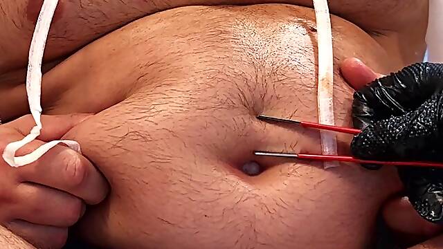 Clinical Insertion: Deep Bellybutton Exam